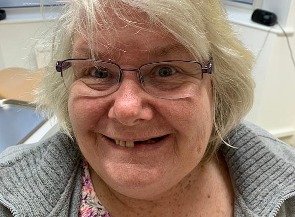 Before dental implant treatment