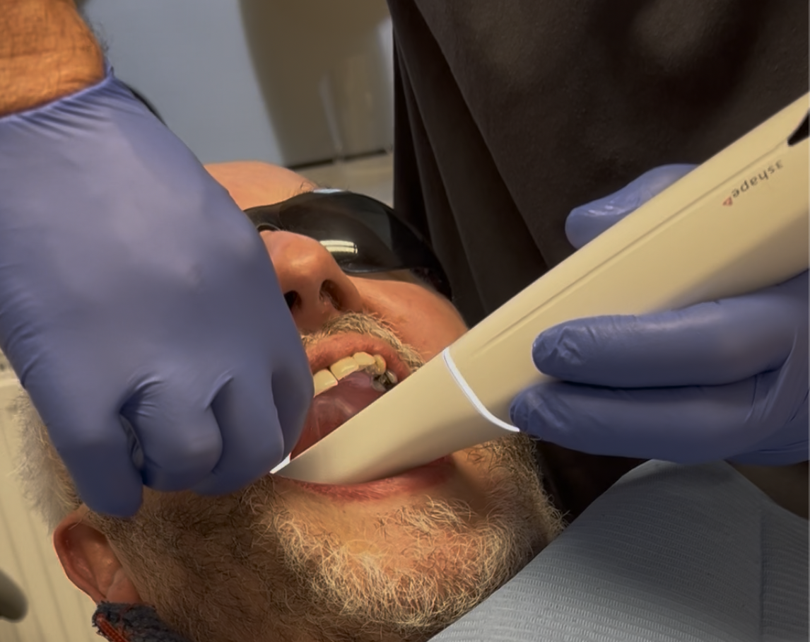 Advanced 3D CBCT scanning equipment