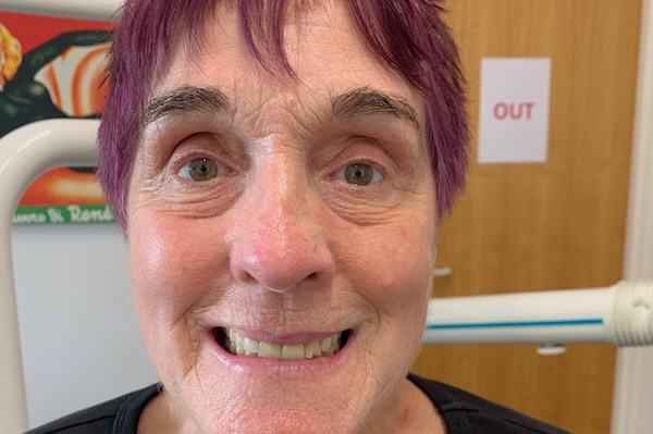 Chrissie, patient at Pure Implant Health Birmingham