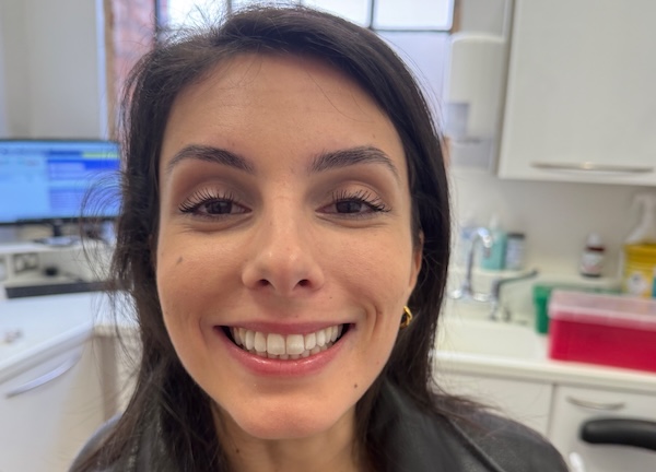 Rachele, patient at Pure Implant Health Birmingham